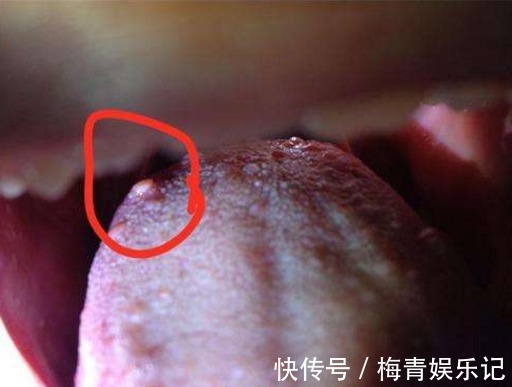 发病率|28岁清华学霸癌症离世,医生告诉:癌症是可怕的,日常需多多注意