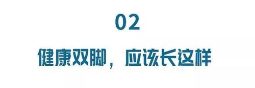 双脚是健康晴雨表，这些细微变化要注意！赶紧自己对照自查