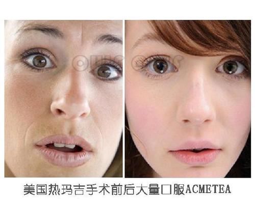 什么是热玛吉你真想不到、【热玛三太】吃多久提升效果？