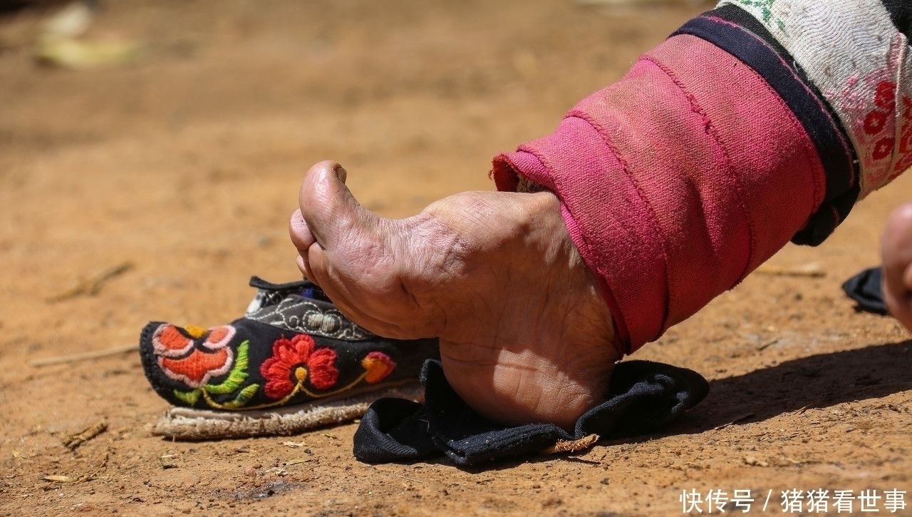三寸金蓮@延續(xù)千年的纏足對于女性的殘害有多深?揭秘三寸金蓮的血淚史。
