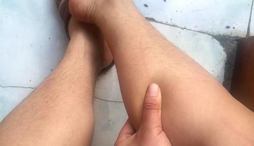 皮肤干燥|一脱裤子,腿上就掉白屑 提醒:1种维生素及时补,问题或可缓解