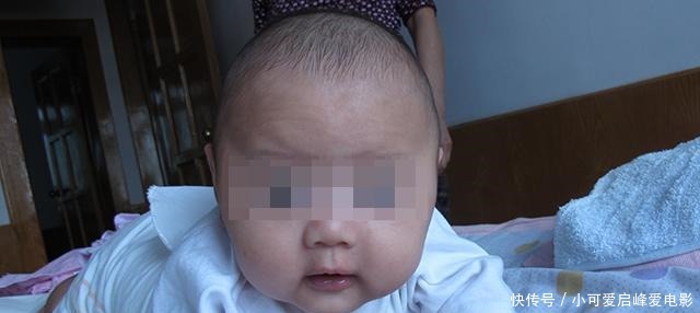 宝出生以后|囟门闭合的时间,对大脑发育有什么影响如果是第三种就该注意了