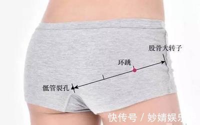 调理|臀,一身阴浊之所在,臀部一堵,全身受苦!中医教你一招去除病根