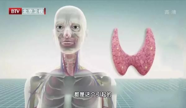 甲状腺疾病|当心！3种舌象，可能提示甲状腺疾病！
