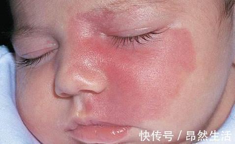 怀孕期间|胎儿自带“记号”,与孕妈错误行为有关,孕妈的放纵终由孩子买单