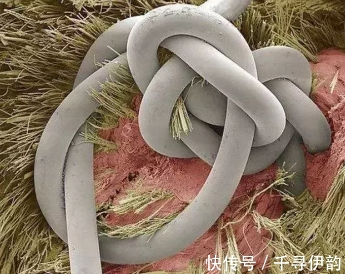 过程|显微镜下的“异世界”排卵过程像火山爆发!