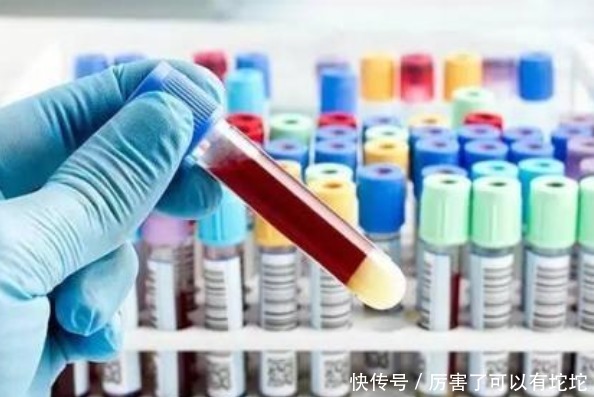 血液|血管“清洁工”被发现,不是木耳,你若爱吃,降血脂,血管干净净