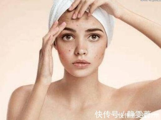 一步之遥|如果你有3个护肤习惯,那么痘印离你只有一步之遥!请小心