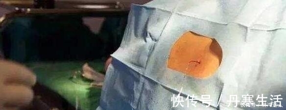 丁妈妈|为啥剖腹产大多在上午?四个好处医生不说也要知道,关系产妇健康