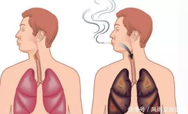 一天一包烟和三天一包烟,哪个伤害更大,为了健康不妨了解一下