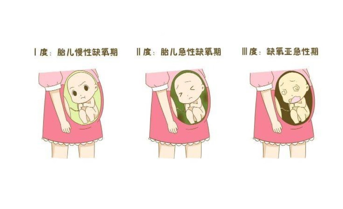 羊水|孕期羊水浑浊容易伤宝宝!做到4不碰,可让羊水保持清澈!