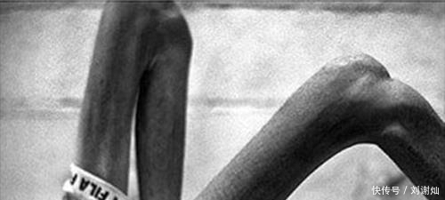 携带者|专家提醒:“如何识别艾滋病携带者,出现这些症状赶快去医院”