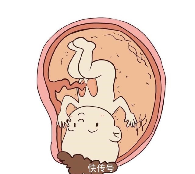 脐带脱垂|女性一生能做几次剖腹产想要二胎的要注意了！