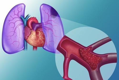 腹泻|男子腹痛腹泻，迅速休克病因未明，直至医生看到：患者胸口上红点