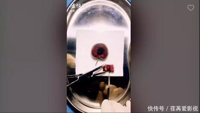 王醫生|32歲醫生竟給水果做手術？一夜吸粉12萬！網友：“我的膝蓋跪爛了”