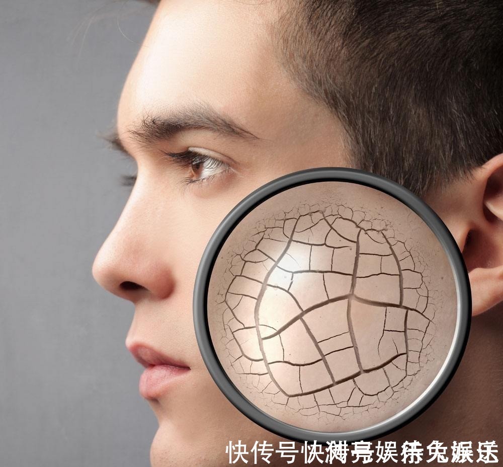 红枣性温|皮肤干燥、瘙痒多半是“血虚”,送你一个补血方,轻松搞定!