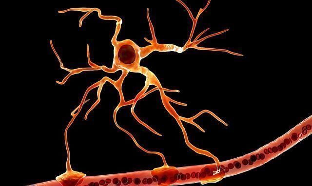 吸烟|血管的“去污剂”不是芹菜，平时紧着吃，给血管冲冲澡，血脂降了