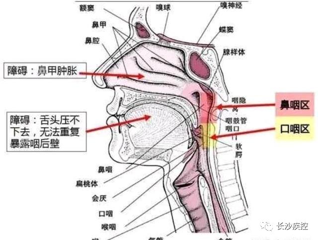 口咽拭子|核酸检测为什么要采口鼻，不能采耳？疾控专家告诉你原因