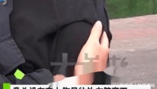 变性手术|变性手术?男子去做面部整形,结果错做成了丰胸,还给做失败了