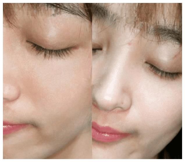 皮肤|皮肤差？原来这才是问题！快看看精华液的正确使用方法。