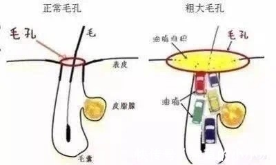 洗面奶|把脸打湿，就上洗面奶？做不到“这几点”，别怪毛孔粗大易长痘