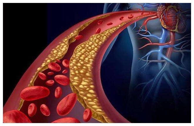 肺热|人到中年，血液变得浓稠咋办常用这种叶子泡水喝，更护血管