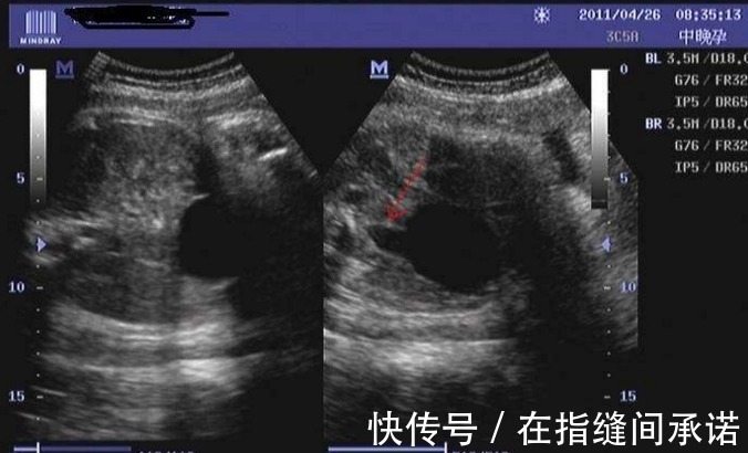 小家伙|孕期孕妈如果有这三种表现，恭喜你胎儿智力发育很好