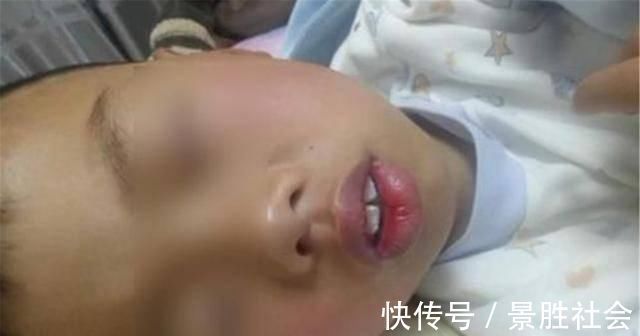 儿子|儿子越长越像“大猩猩”,宝妈调侃长残了,朋友提醒才去医院检查