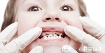 牙齿|宝宝的牙齿问题多又多，快来看看这几种解决方法吧