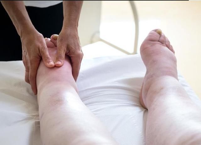 生理性|孕期“生理性水肿”和“病理性水肿”的区分，以及缓解水肿方法！