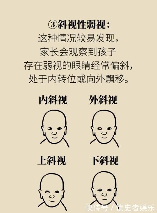 弱视|弱视的危害远大于近视？一个小游戏能辨认