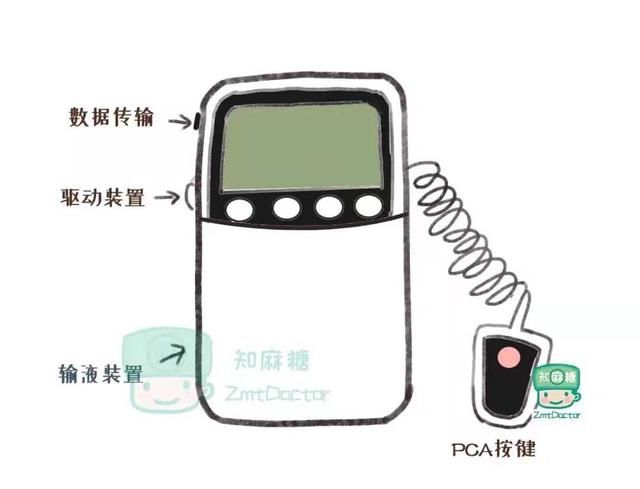 止痛|都知道镇痛泵止痛，但会不会影响身体康复呢？