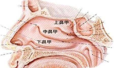 上皮细胞|鼻甲肿大，竟然可以这样消肿