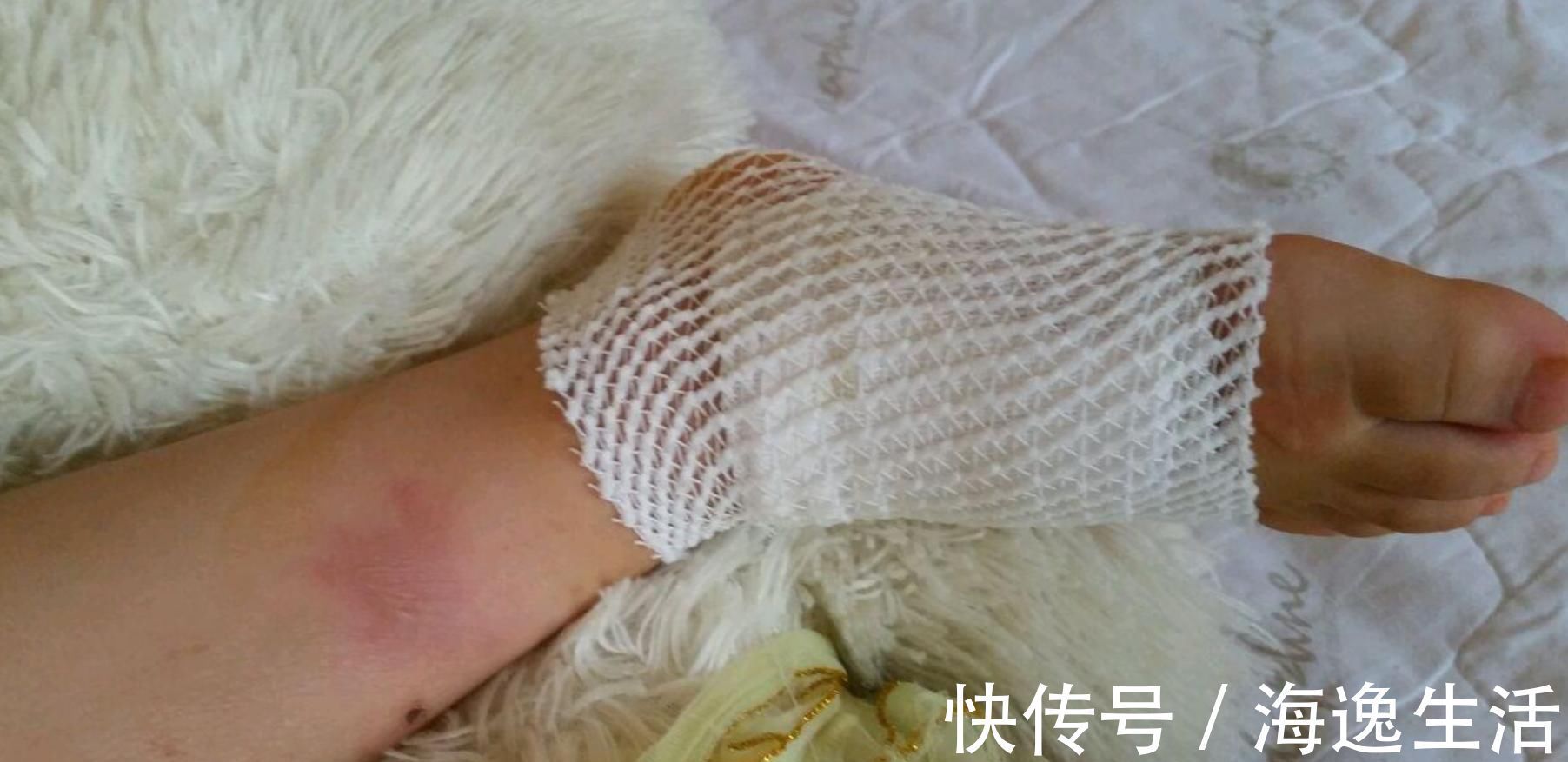 孩子|孩子烫伤,奶奶用“偏方”直接导致孩子休克,行不通的别硬来