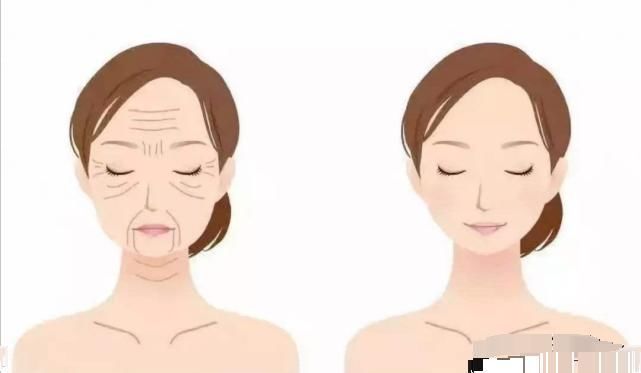 皮肤|女人有这3个特征,看起来比同龄人要显老