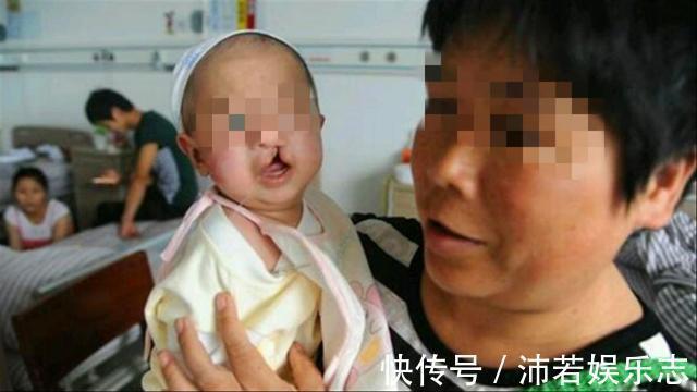 兔唇|产妇生下''兔唇宝宝'',谎称孕期吃了兔肉,医生说破后婆婆很生气