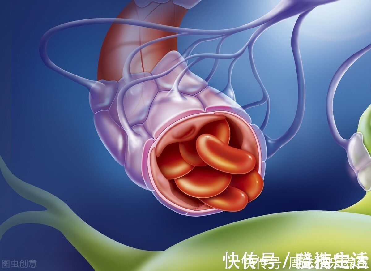 血管|高血脂了34年，血管依旧柔软，血脂平稳，医生：4件事值得学习