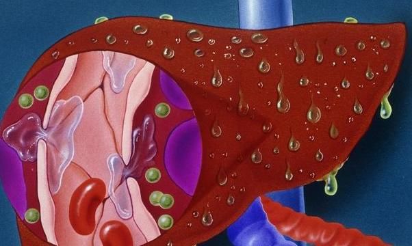 肝气郁滞,中医教你一个调理法-中医调理-港邦健康