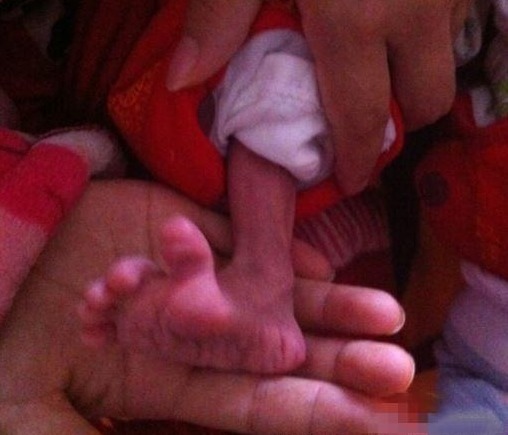 医生|宝宝出生25天就像个小老头,医生的一席话,让父母恨自己也太不上心了