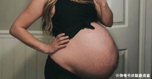 宝宝|预产期到了,怎么让宝宝“尽快发动”?试试这几个“催生妙招”