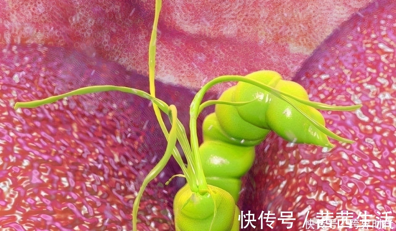 幽门螺杆菌|37岁阿姨，幽门螺杆菌转阴，肠胃科专家：她的做法，值得学习