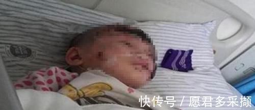 医生|4岁男孩掉进180度油锅,奶奶神操作救了孩子,医生:模范操作