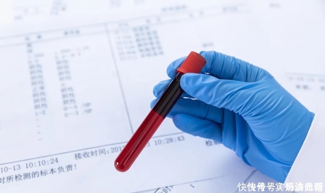 看病|哪些检查要空腹？空腹可以喝水吗？搞懂5个问题，看病检查不白跑