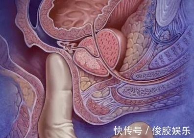 白领|32岁女白领查出肠癌离世,医生解释两个习惯害的