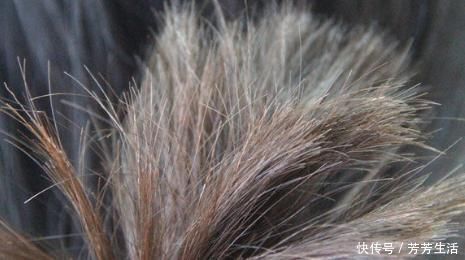 头皮里扣出“白泥”?不是头皮屑那么简单,以下几个问题要重视