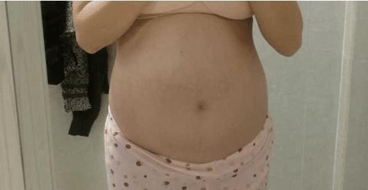 完善|孕11周被诊断畸形,胎宝宝逆转发育完善,罪魁祸首是它