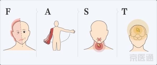 世纪坛专家：头晕、走路像踩棉花是怎么回事？