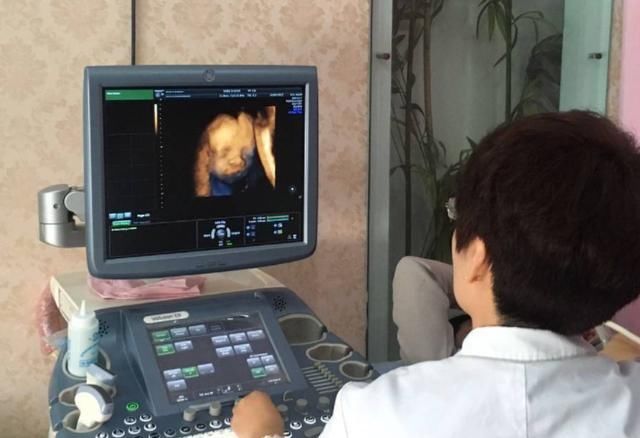 妈妈|胎宝在做四维时“好害羞”，折腾人还“白花钱”，怎样才会露脸？