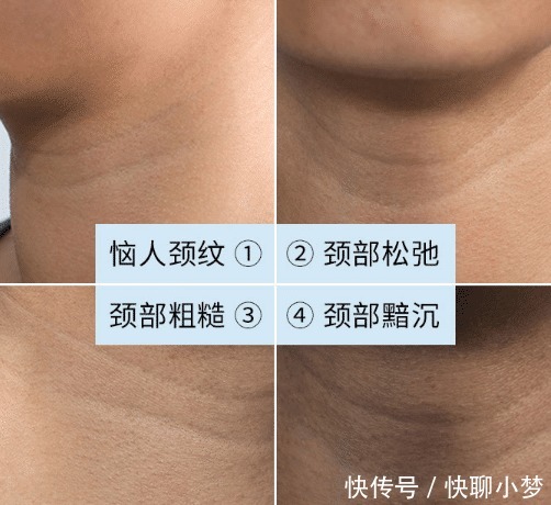 产品|皮肤科医生提醒:这几款火爆全网的护肤品,含有刺激性激素