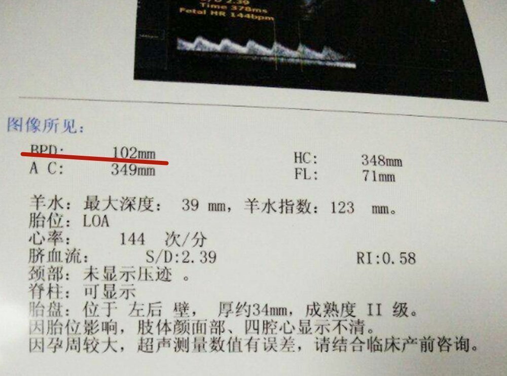 双顶径|“胎儿头大不能顺产”产前双顶径多大,孕妈才能顺利自然分娩